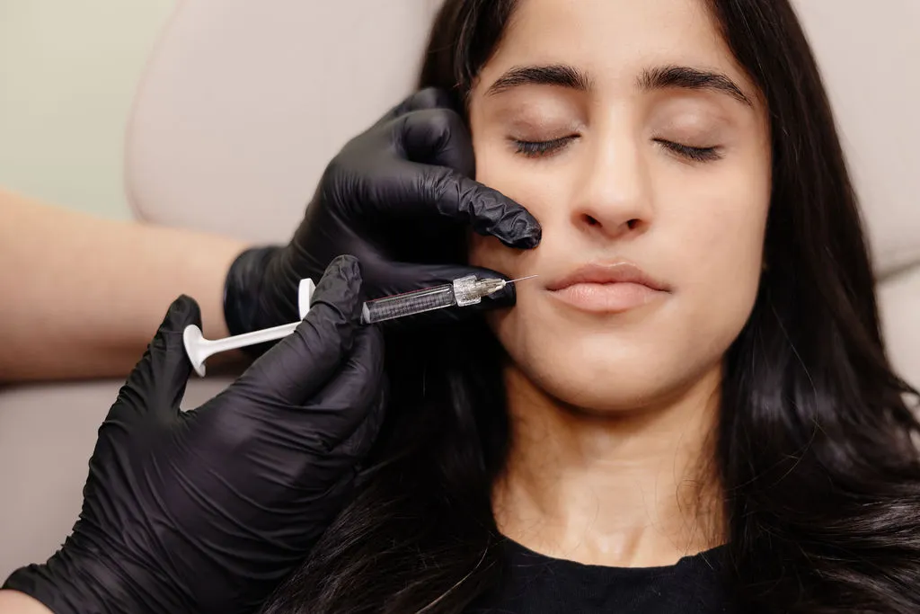 A patient receives a lip filler injection at the upper lip