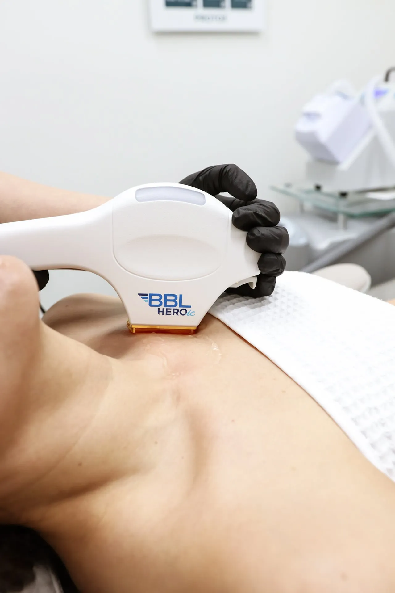 The BBL handpiece resting on a patient’s décolletage during a SkinTyte® session
