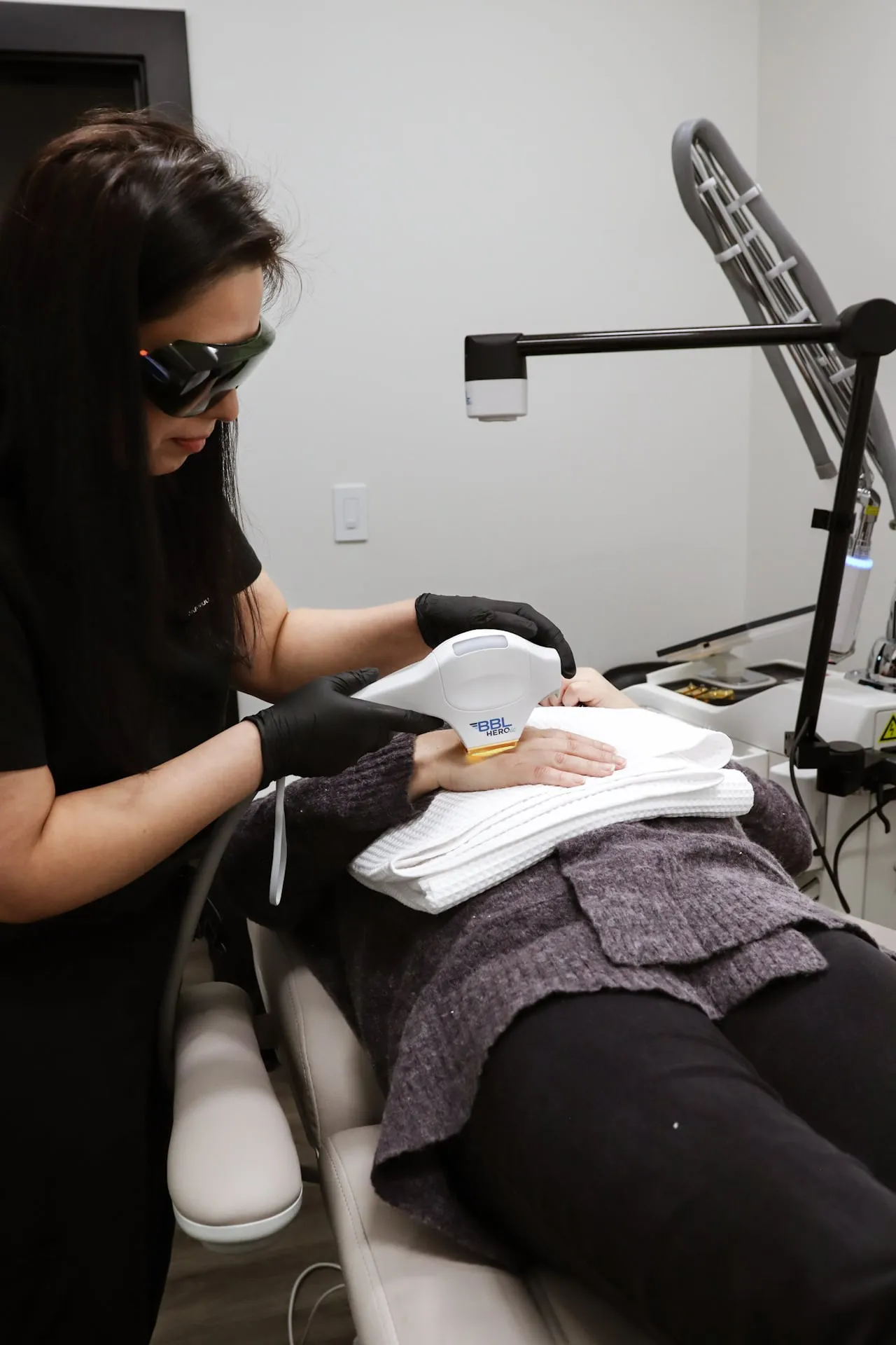 A BBL handpiece treating sun damage on a patient’s hands