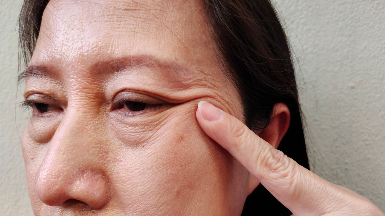 Loose Skin Treatment