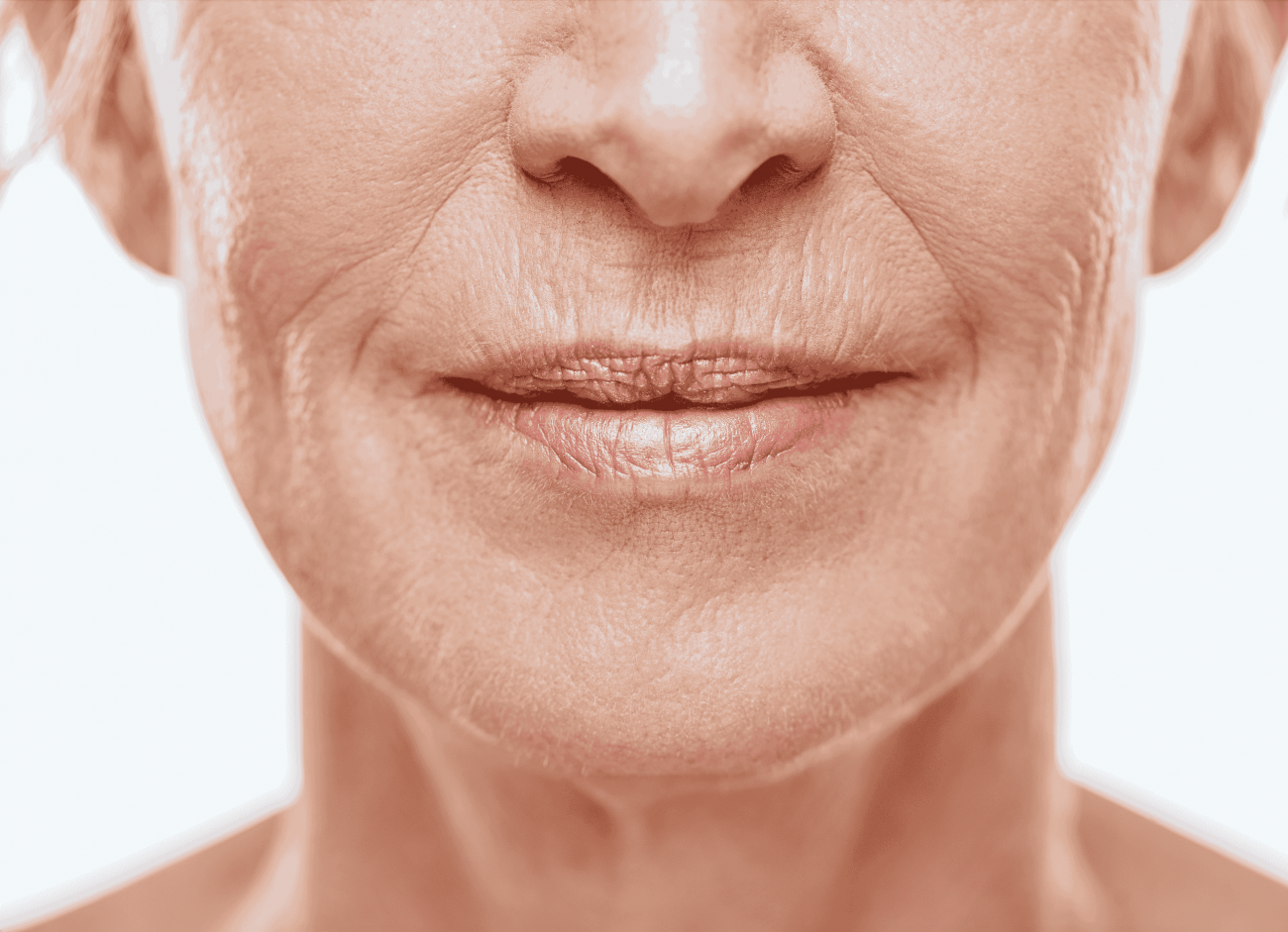 Wrinkle Treatment