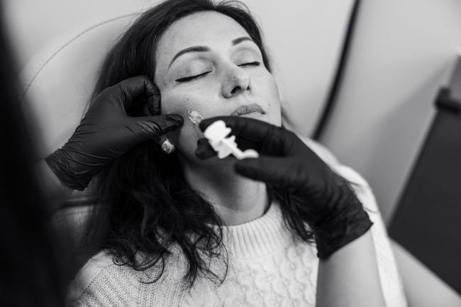Dermal filler treatment being performed at Serene Rejuvenation in Surrey, BC